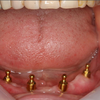 Мирбол Кадешов, Актобе Фото - 5