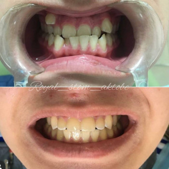 Royal stom, Актобе Фото - 5