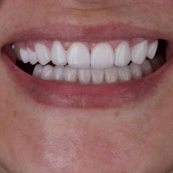 Dental centre, Aktobe Фото - 5