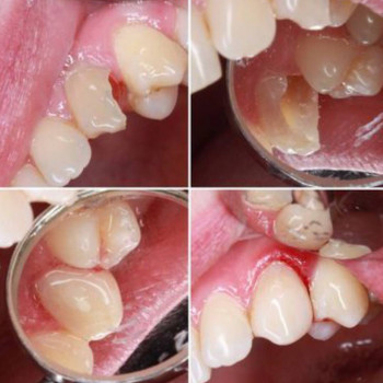Зуб'ОК, Aktobe Фото - 5