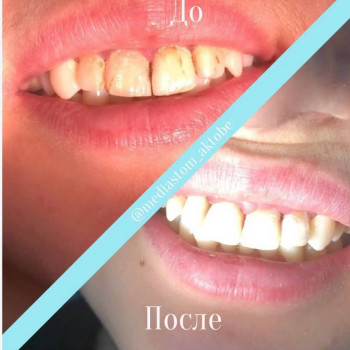 Media stom, Актобе Фото - 5