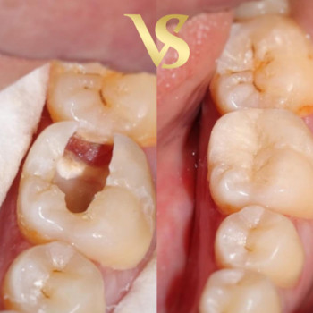  Via Stom, Aktobe Фото - 5