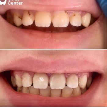 Smile center, Актобе Фото - 5