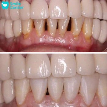 Smile center, Актобе Фото - 6