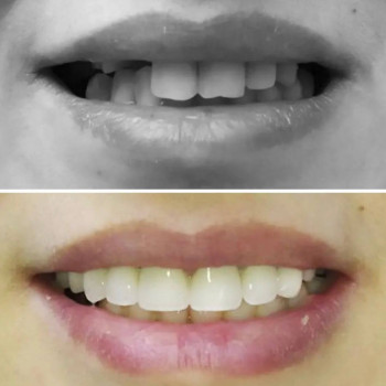 Nur stom, Aktobe Фото - 5