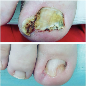 Iryna Rusyn, Rybnik Фото - 5