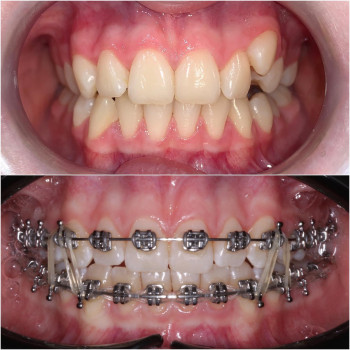 Коралл, Алматы Фото - 5