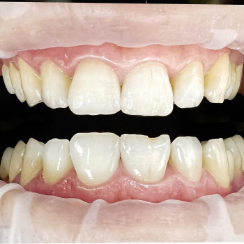 Izumrud, Алматы Фото - 5