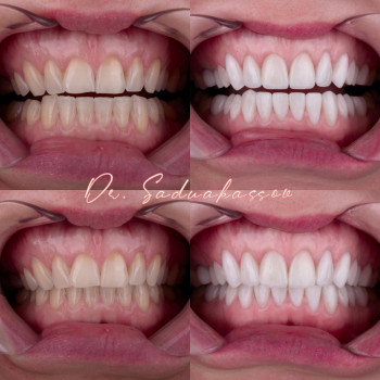 Омирбек Садуакасов, Алматы Фото - 5