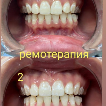 Клиника стоматологии доктора Волобуевой, Алматы Фото - 1