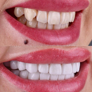 Баглан Галымович Шаншаров, Алматы Фото - 5