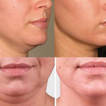 Эва , Karaganda Фото - 5