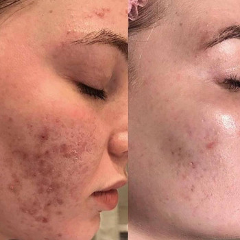 Акбота , Караганда Фото - 5