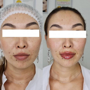 Динара Тортаева, Karaganda Фото - 6