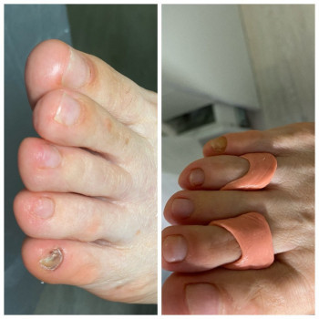 Татьяна Адаменко, Клайпеда Фото - 5