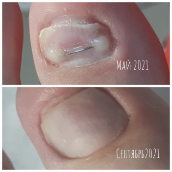 Татьяна Адаменко, Клайпеда Фото - 6