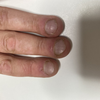 Татьяна Адаменко, Клайпеда Фото - 10