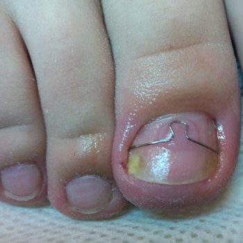 Татьяна Адаменко, Клайпеда Фото - 11