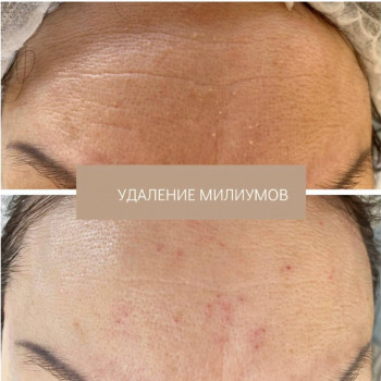 Лолита Зелинская, Караганда Фото - 6