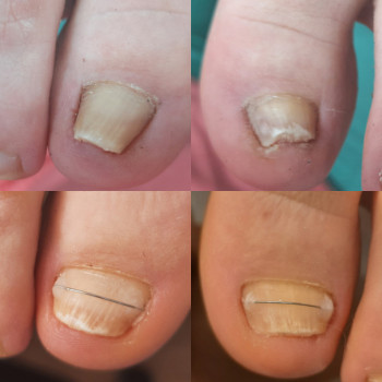 Olena Koval, Warszawa Фото - 21