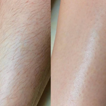 Алия , Караганда Фото - 5