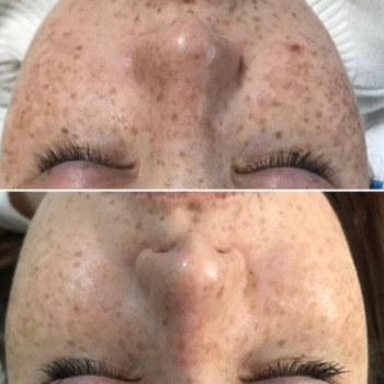 Надежда Корнеенкова, Karaganda Фото - 5