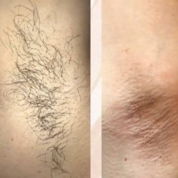 Арушан , Karaganda Фото - 5