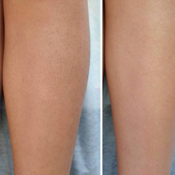 Куралай , Karaganda Фото - 5