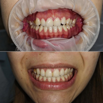 We Stom, Алматы Фото - 5