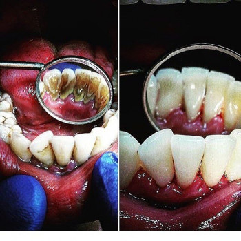 Дилмурат Дилшатович , Алматы Фото - 5