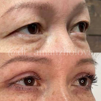 Динара , Karaganda Фото - 6