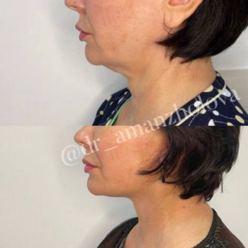 Динара , Karaganda Фото - 7