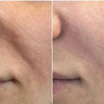 Аделия Мукау, Almaty Фото - 5