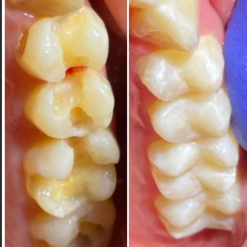 Эльдар , Караганда Фото - 5