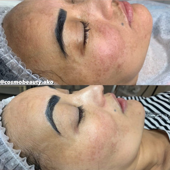 Акерке Турган, Алматы Фото - 5