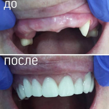 Мустафин , Караганда Фото - 5