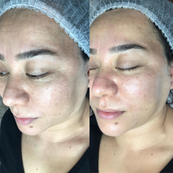 Дильбар Ахметова, Almaty Фото - 5