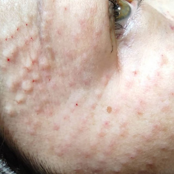 Толкын Тлеухан, Astana Фото - 5