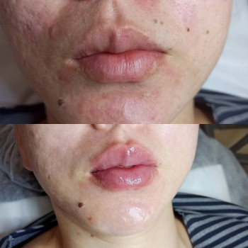 EstetCosmo, Астана Фото - 5