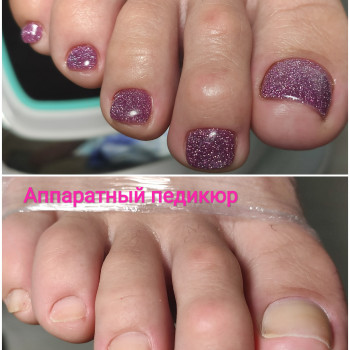 Pedikúra s přístrojem na pedikúru