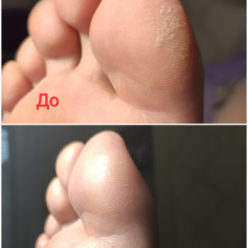 Pedikúra s přístrojem na pedikúru