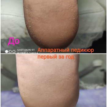 Pedikúra s přístrojem na pedikúru