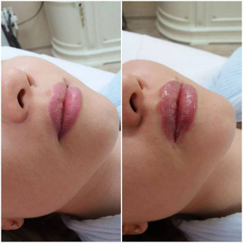 Alanda, Karaganda Фото - 5