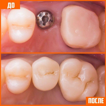 Еtalon, Караганда Фото - 7