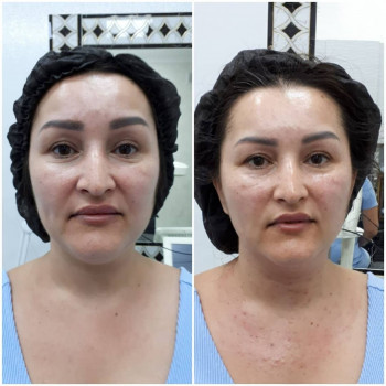 Наталья Сизоненко, Taraz Фото - 5