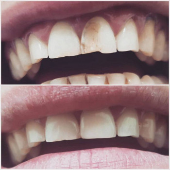 Beauty dent, Karaganda Фото - 5