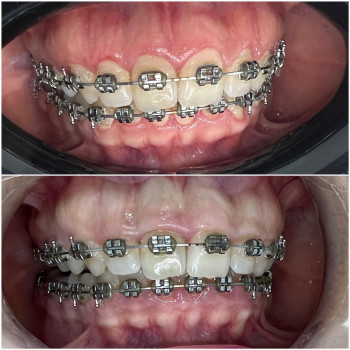 Нурила Ержановна Есим, Taraz Фото - 5