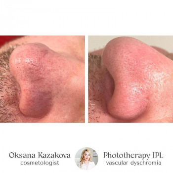 Оксана Казакова, Нью-Йорк Фото - 6