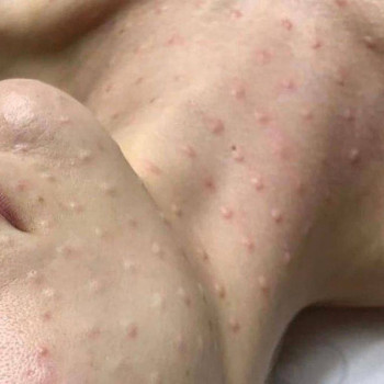 Натали , Нью-Йорк Фото - 6