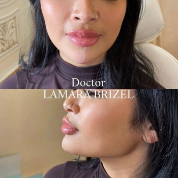 Ламара Бризель, Нью-Йорк Фото - 5